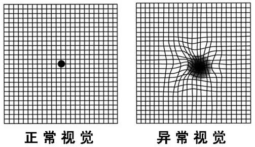Led照明中藍(lán)光危害，尤其是對兒童。